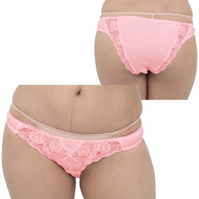 �Q�������X�g���b�`�O�ヌ�[�X�I�[�v���t���o�b�N�@�s���N